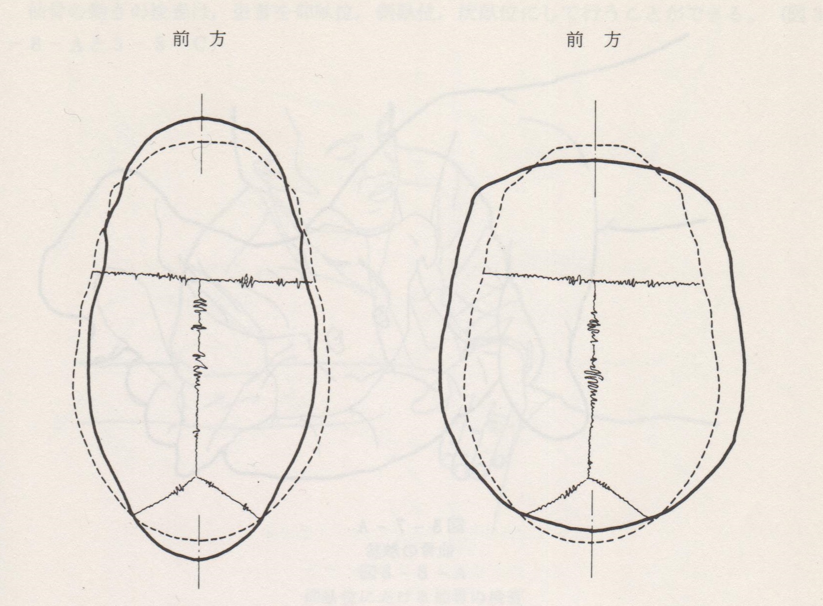 初学者のための頭蓋治療入門 まほせら